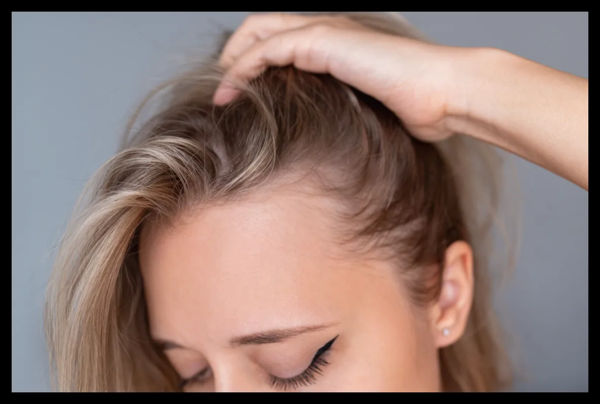 خشکی پوست سر و خارش؛ آیا فقط کمبود رطوبت علت است؟